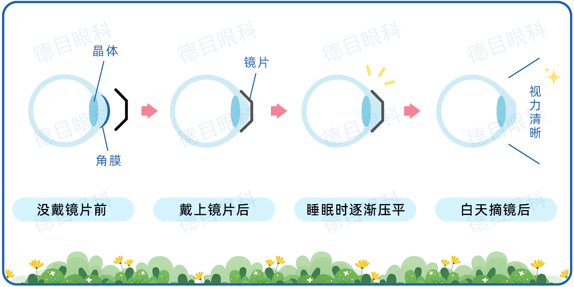 ok镜可以治疗近视眼吗图片