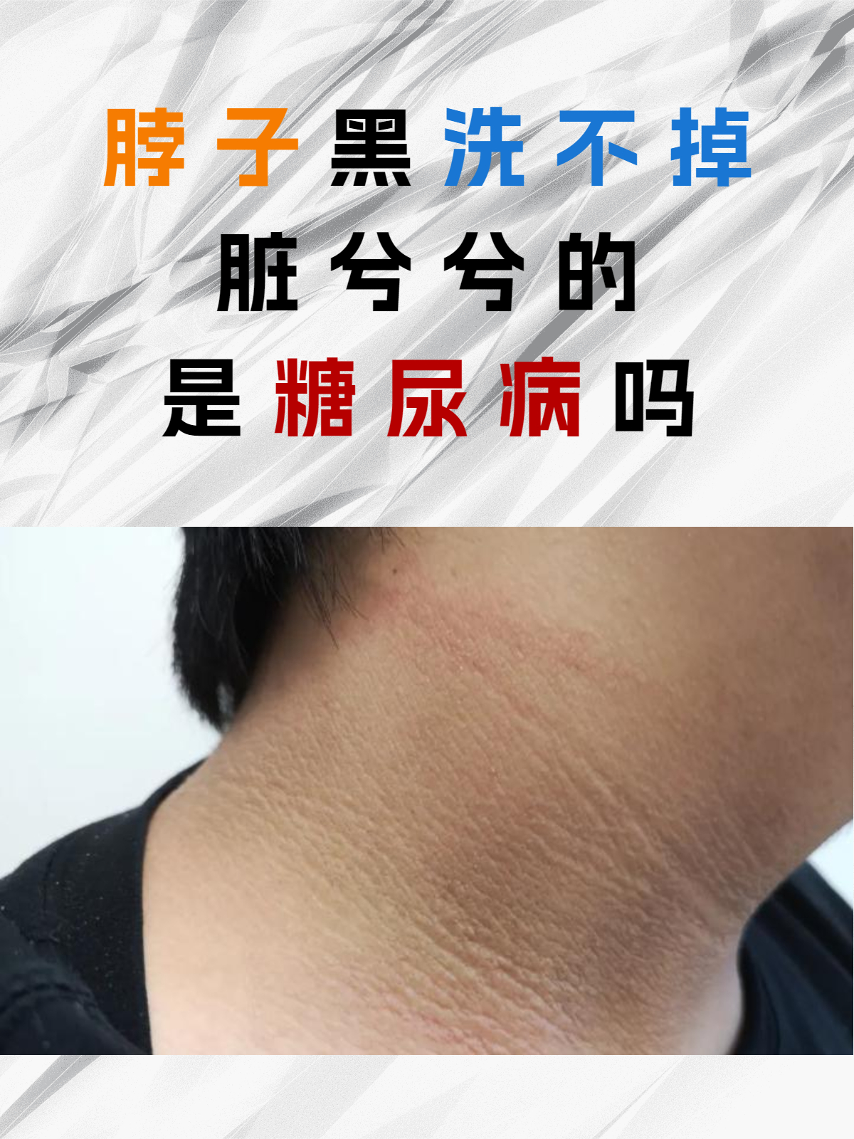 脖子黑洗不掉脏兮兮的是糖尿病吗?