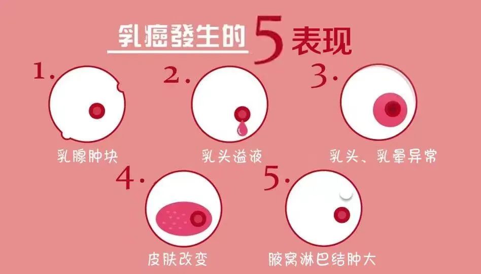 乳腺癌乳房小酒窝图片图片