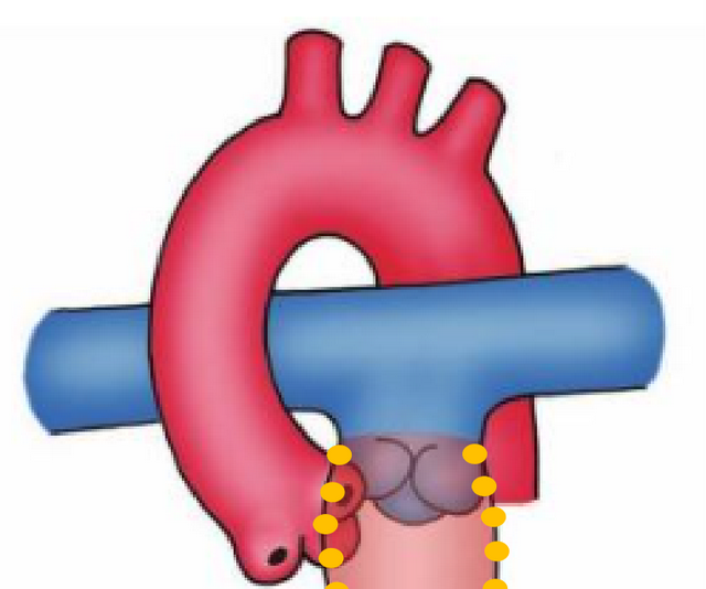 动脉圆锥在哪里?有什么用?