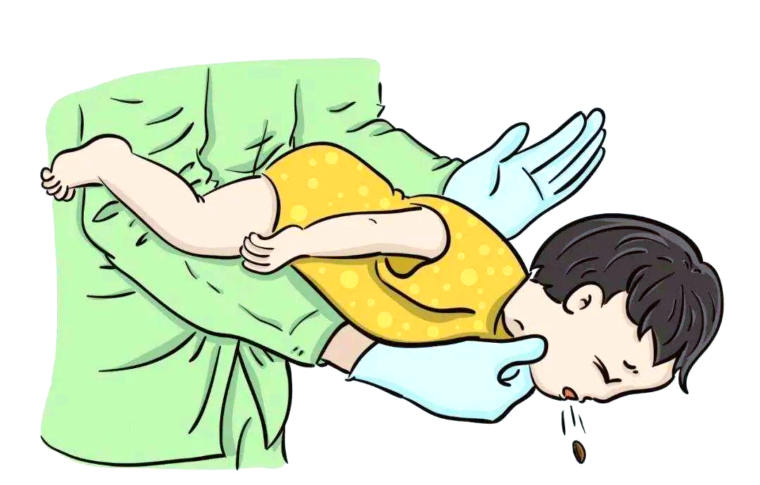 不用机器!海姆立克急救法让你轻松应对窒息