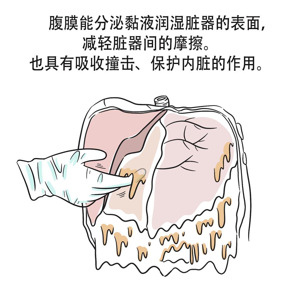 "老大难"腹膜癌能治吗?