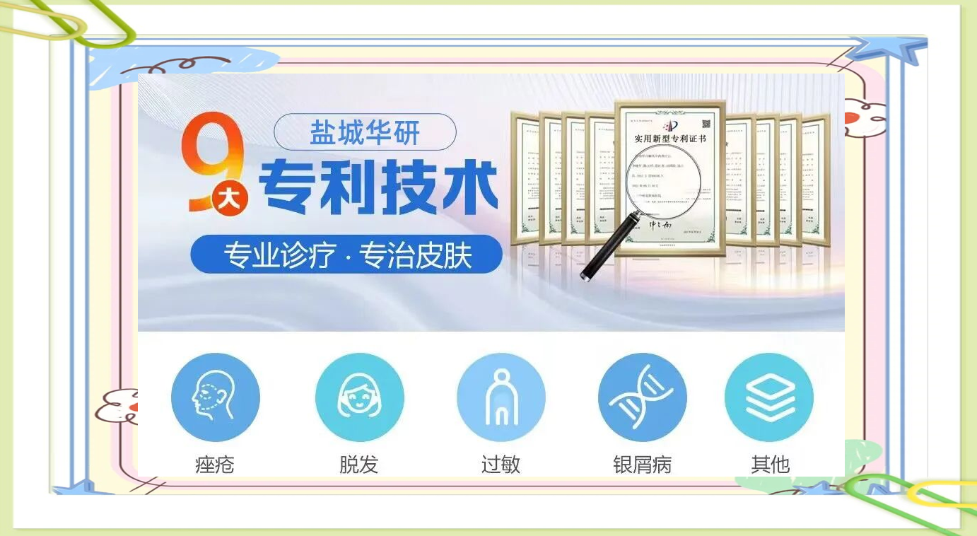 盐城治疗白癜风：寻找适合自己的治疗方法