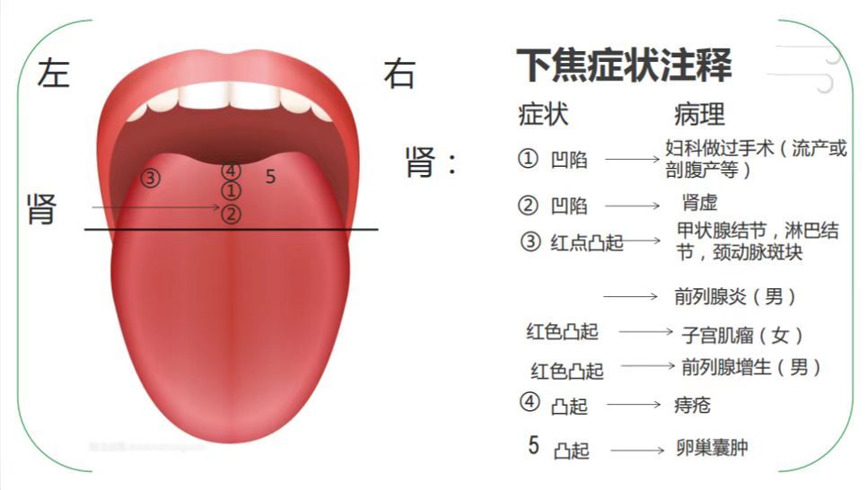 中医特色舌诊分享——基础概论
