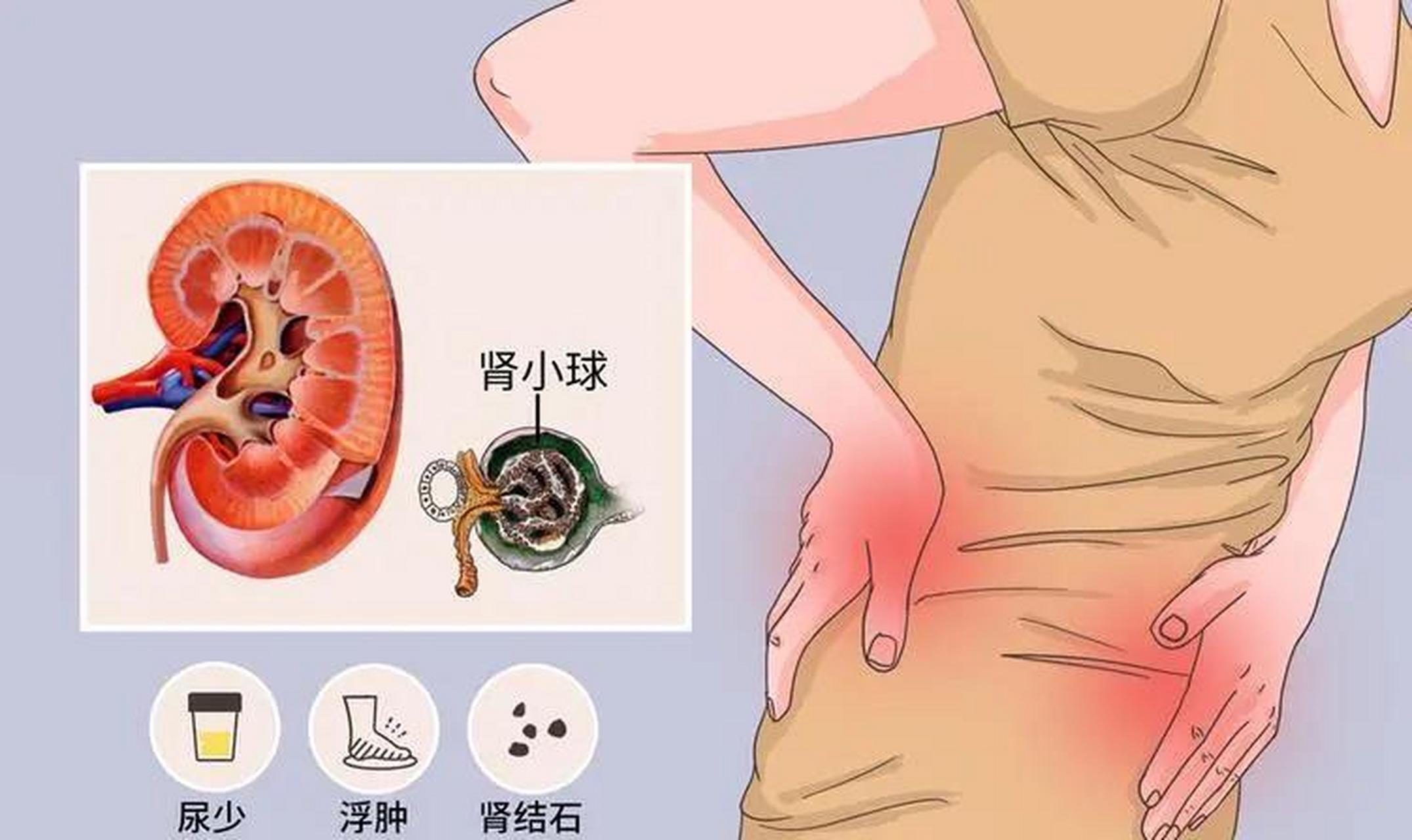 慢性肾功能不全 补肾排毒汤 【处方】熟地 ,山萸肉