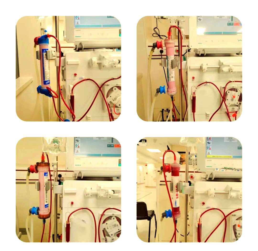 透析器:血透治疗的关键所在