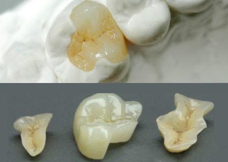 牙齿掉了一块,真的没关系吗?