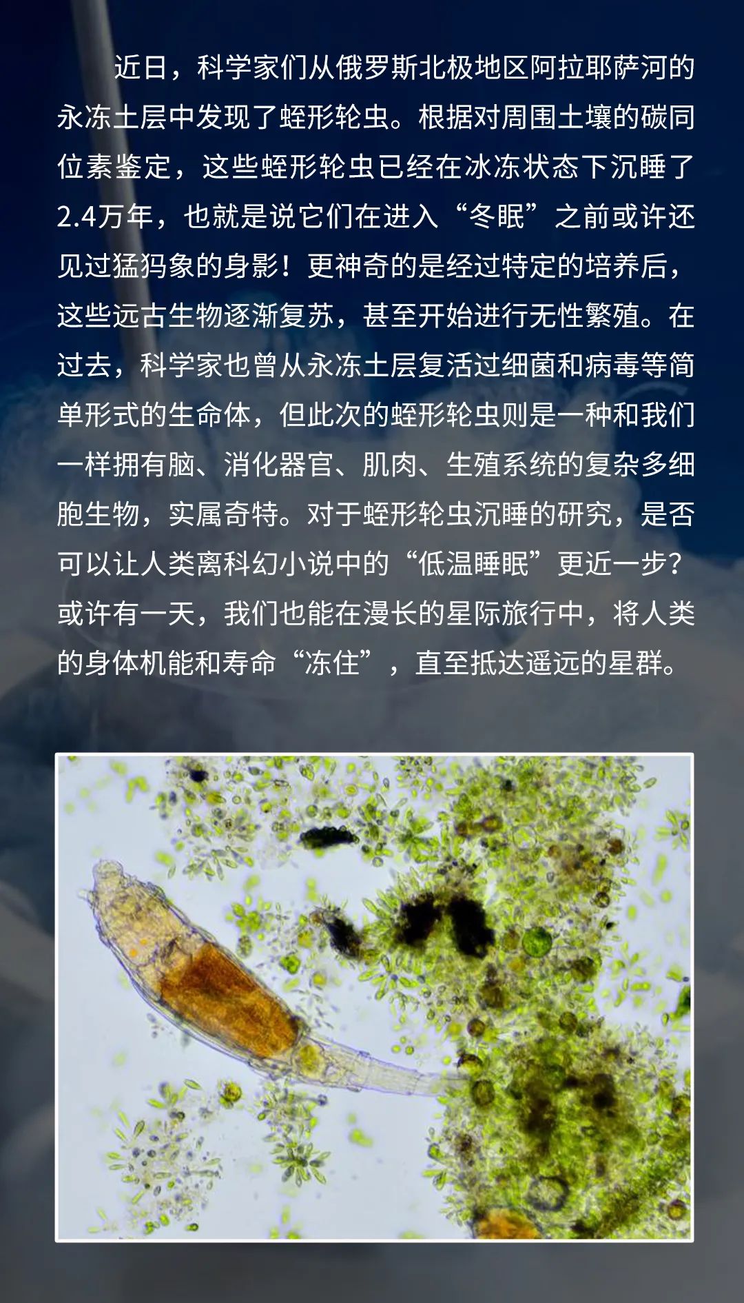 di scovery 本 期 互 动 看完了蛭形轮虫的故事 你是否对星际