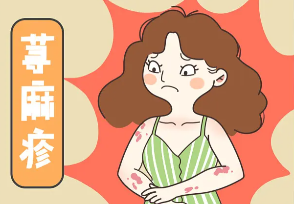 苏州治荨麻疹的中医系列讲堂(3)中医治疗荨麻疹的优势