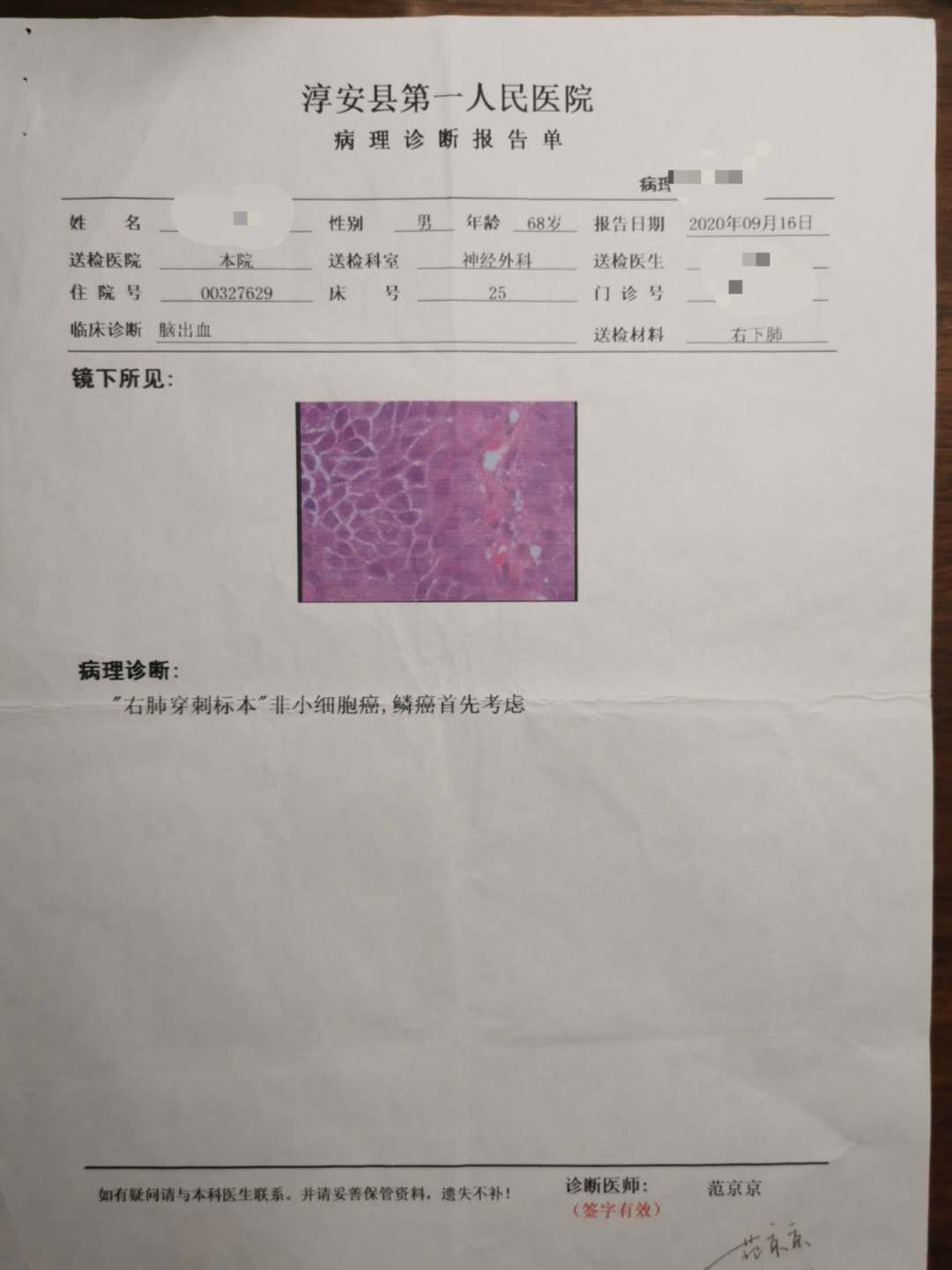 慢性阑尾炎诊断书图片