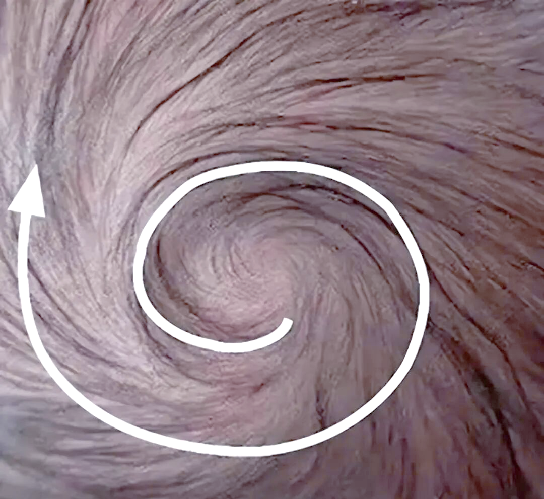 孩子头顶发旋的奥秘与育儿观念的碰撞