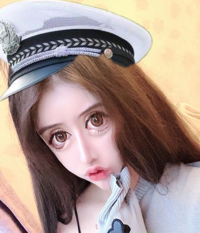 女孩13岁就整容,3年花费100万整容60次,前后对比照判若两人