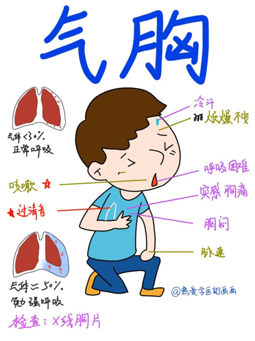 气胸疼痛位置图图片