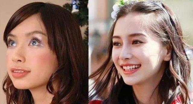 "整牙"堪比"整容",家长有多忽视孩子的牙齿,未来就有多后悔