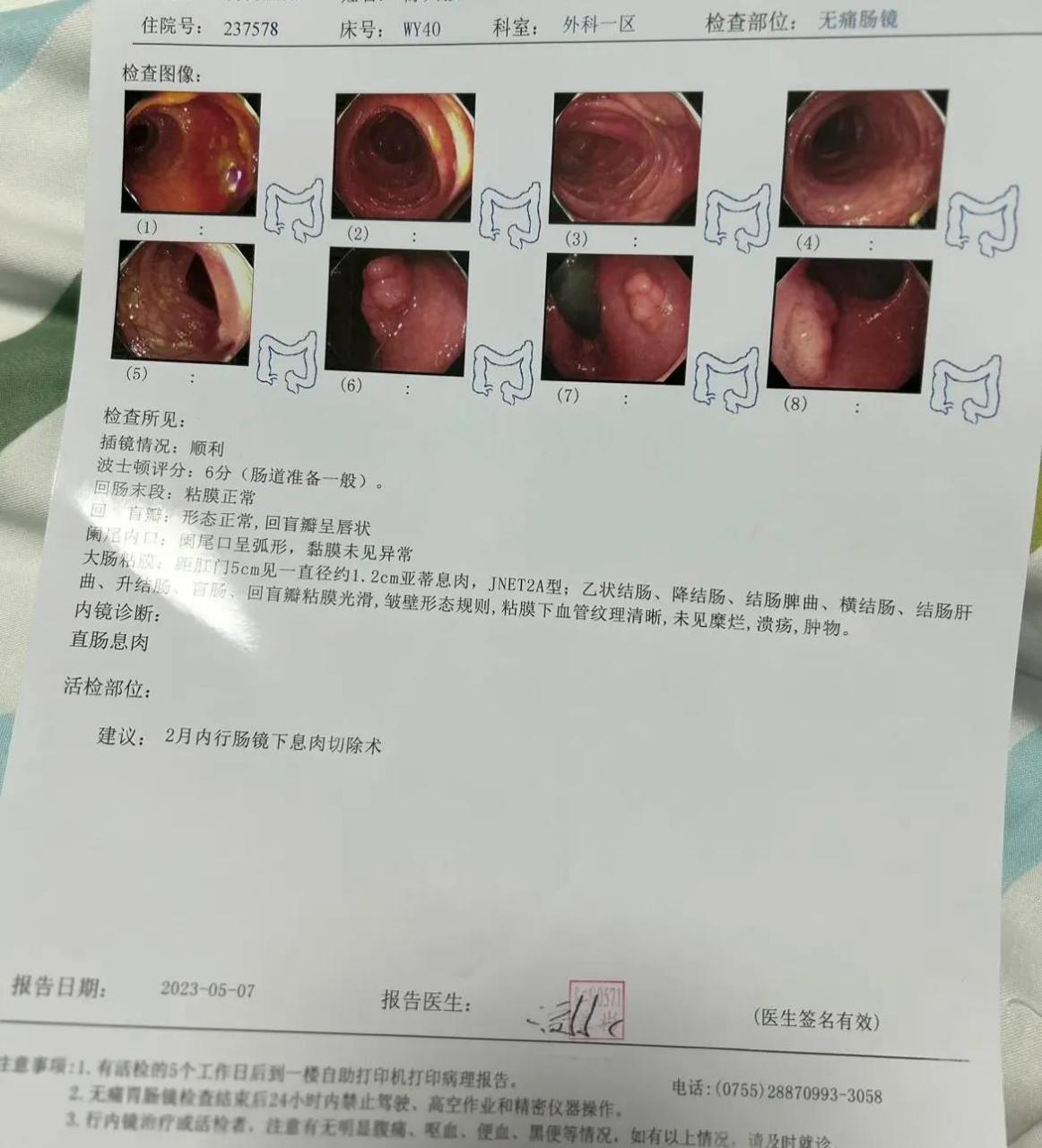 两年前有痔疮,但是基本上不怎么影响生活,就是偶尔菊花会有点痒痒的