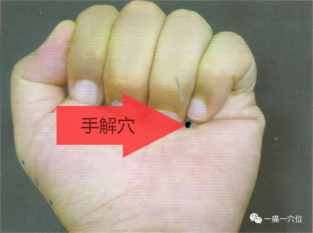 腿抽筋快速缓解法,用力掐一下手解穴,抽筋立即缓解,百试不爽!