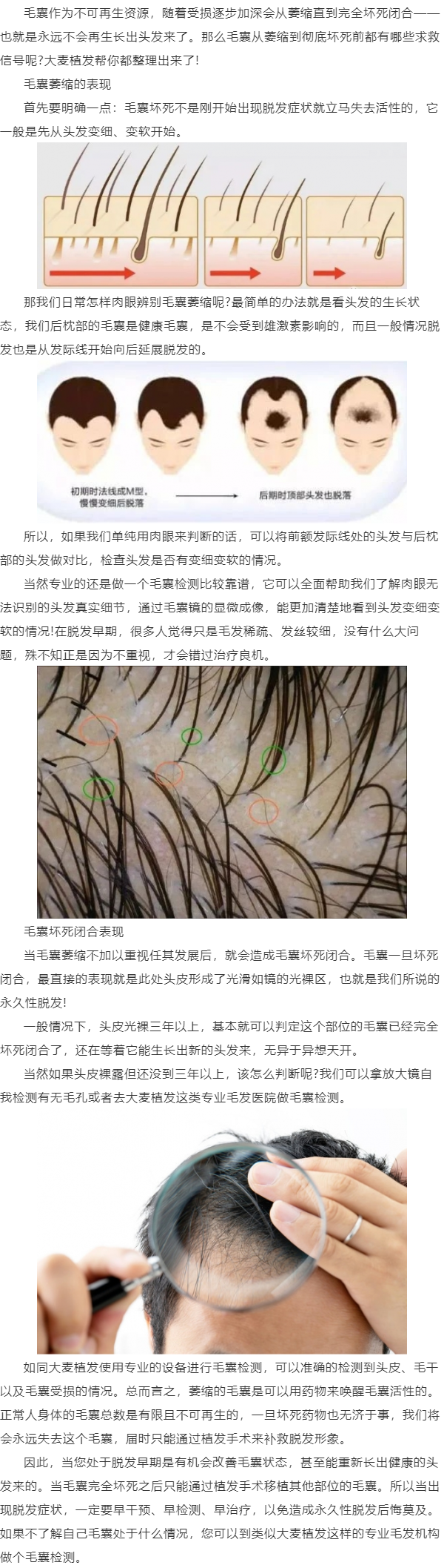 毛囊坏死前的求救信号你知道吗?大麦植发都帮您整理出来了