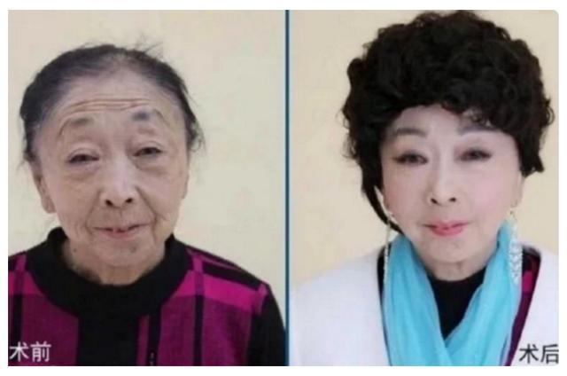 60岁大妈为配得上25岁小丈夫,花光积蓄整容成"少女",现状如何