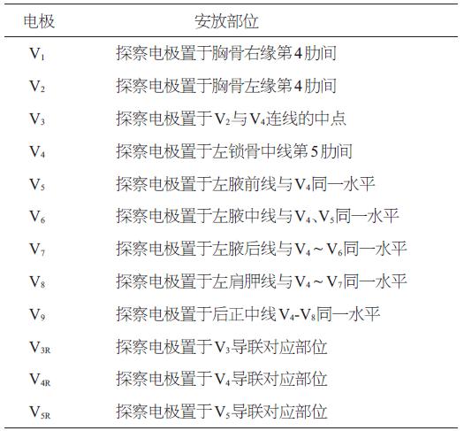 最新发布:18导动态心电图专家共识