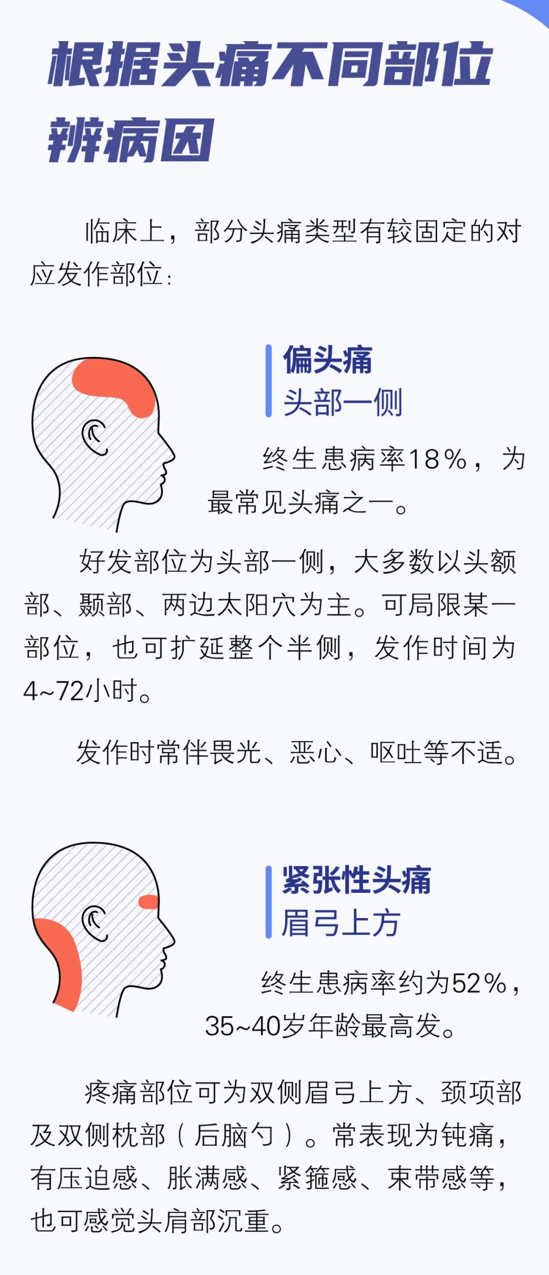 【健康】头痛千百种,你的是哪种?一图对照查看病因