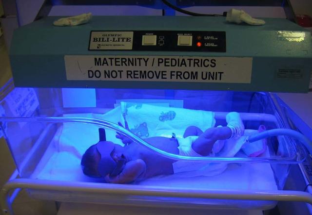 基因突变的蓝色血液人及其蓝色皮肤家族的真实故事