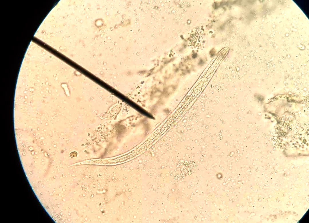 粪类圆线虫与钩虫幼虫的鉴别全攻略