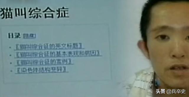 罕见!吉林30岁小伙半夜睡觉发出"猫叫",医生查明真相:没救了