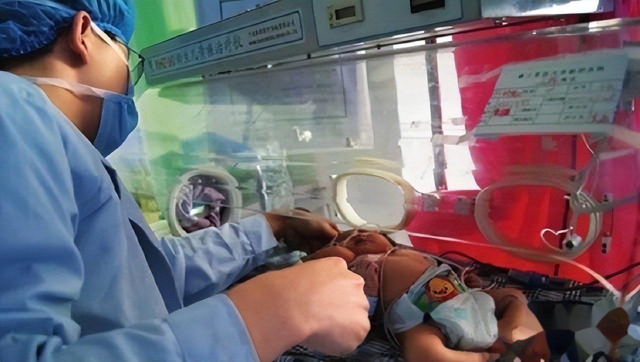 2011年,四川女子生出中国首例"双头婴儿",之后如何了