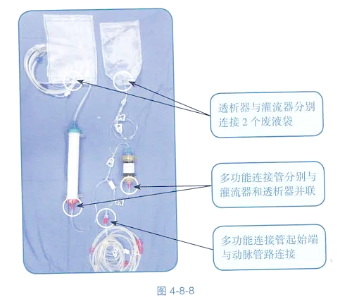 血液灌流技术详解:预冲与回血全攻略