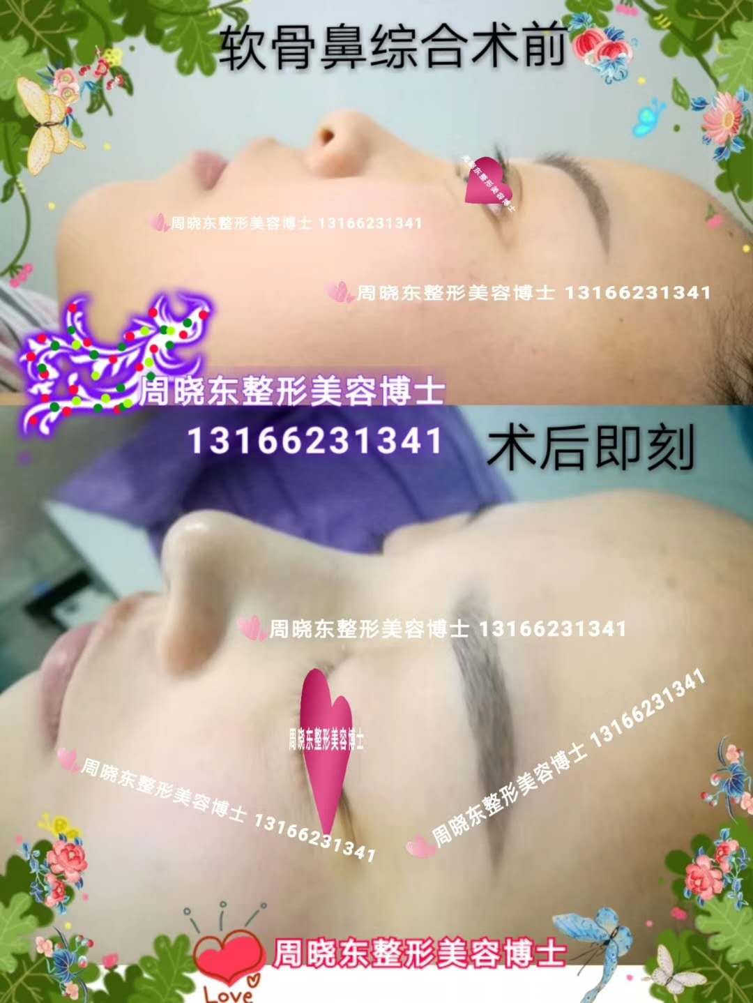 上海周晓东博士整形外科专家