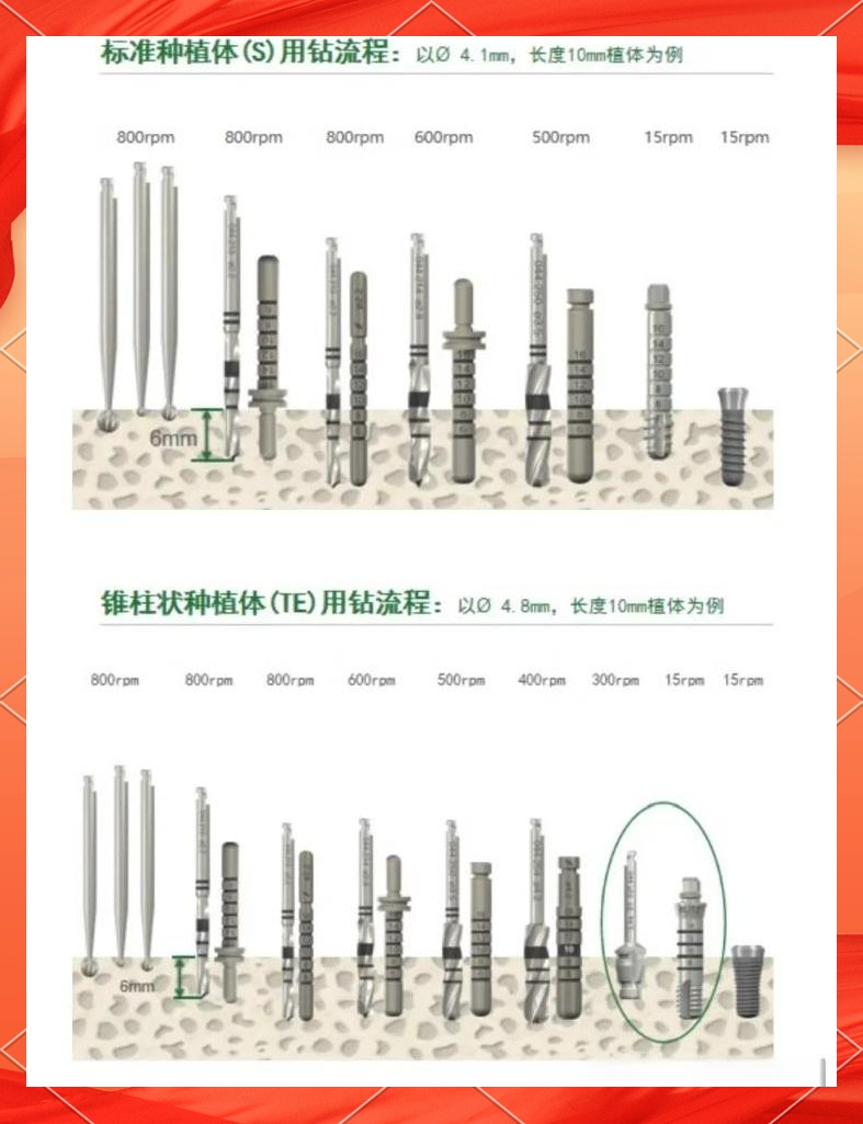 iti种植系统工具盒全面介绍