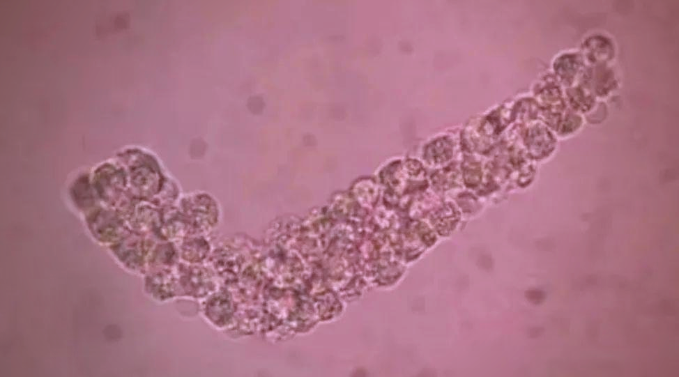 尿液中的多种管型概述