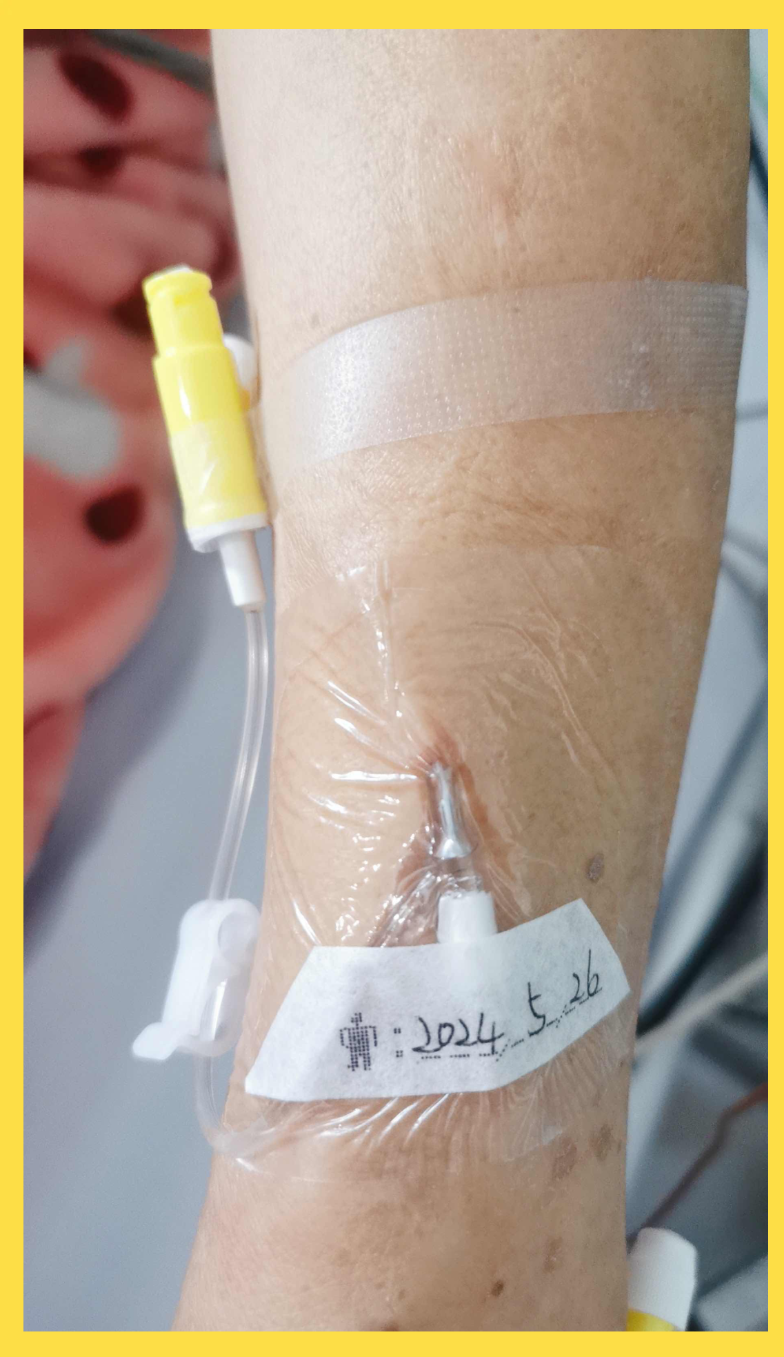 留置针的常见问题与解决方法