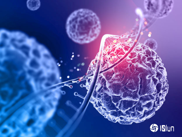 mrna疫苗成功阻止胰腺癌复发,专家视为癌症疫苗里程碑