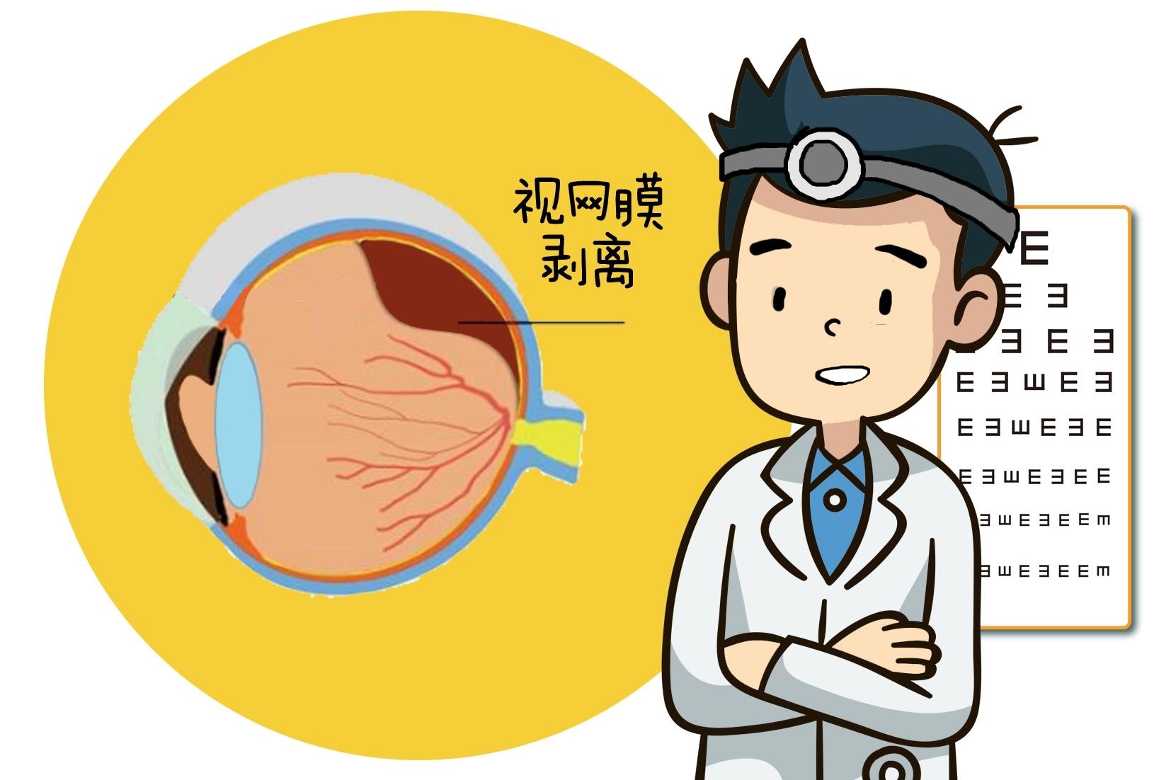 视网膜脱离的年轻人增多,专家表示过度用眼是主因,用眼30分钟需来次"