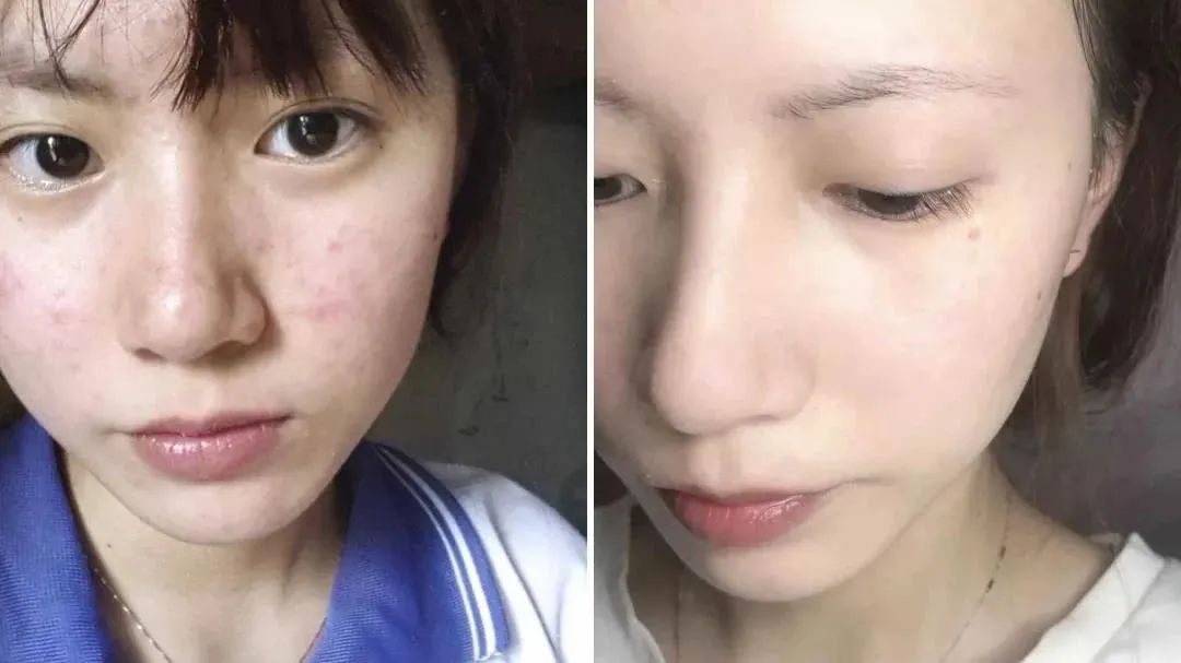 女人常吃它,养出红润好气色