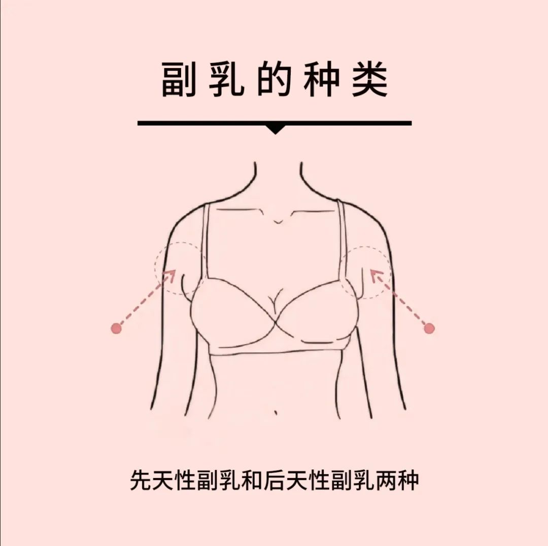 腋窝肉肉如何消减?谷医堂谷方益元教你3招告别副乳尴尬