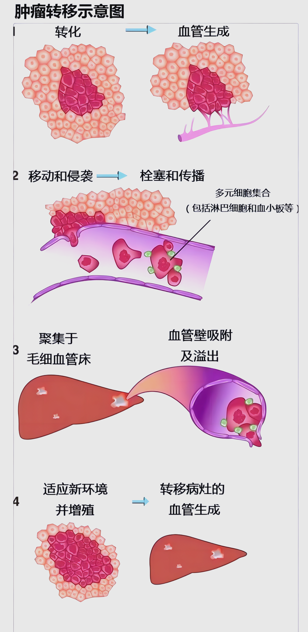 中医视野中的肿瘤转移及乳腺外科临床研究