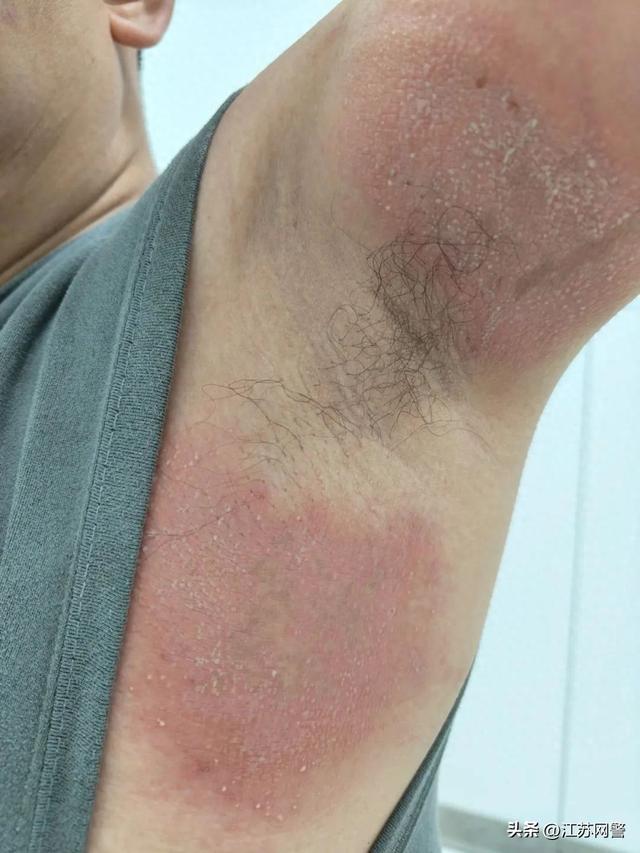 男子随手一拍,手臂烂了!