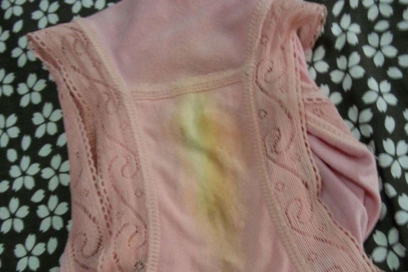 内裤上的"黄色物",里面住着多少病菌,说出来估计没人会相信!