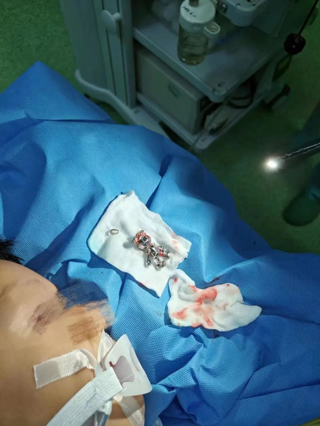 小孩误吞磁铁死亡=小孩误吞磁铁死亡视频