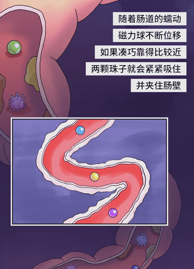 宝宝吃了磁力球的症状=宝宝吞磁力球多久会到肠