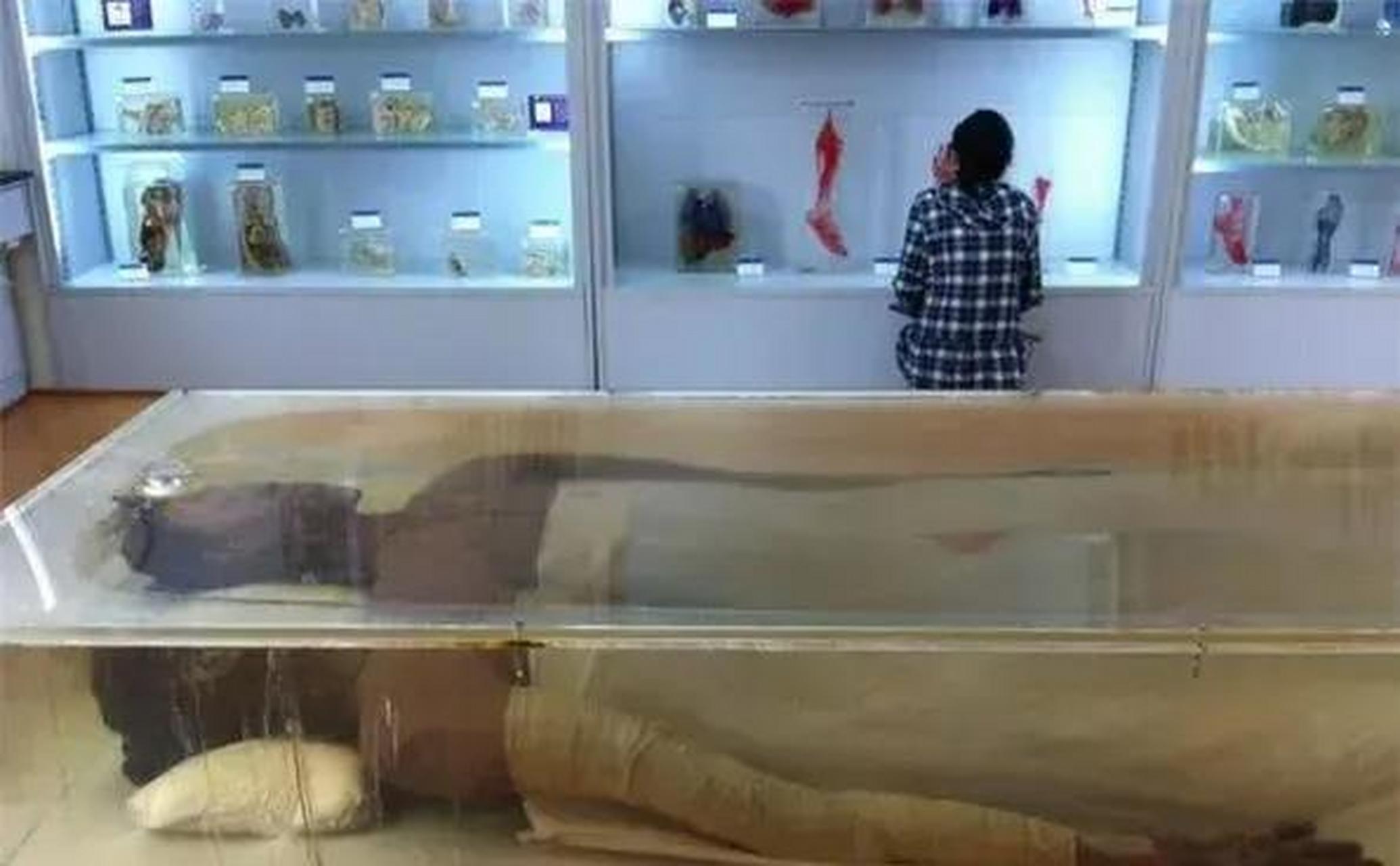 2005年,湖南湘雅医学院,中国"第一女巨人"曾金莲的遗体被安放在标本室