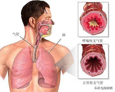 結核病的各種合併症和併發症