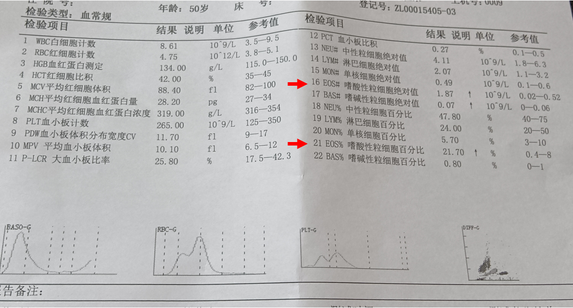 了解一下什么是嗜酸性粒细胞增高疾病?