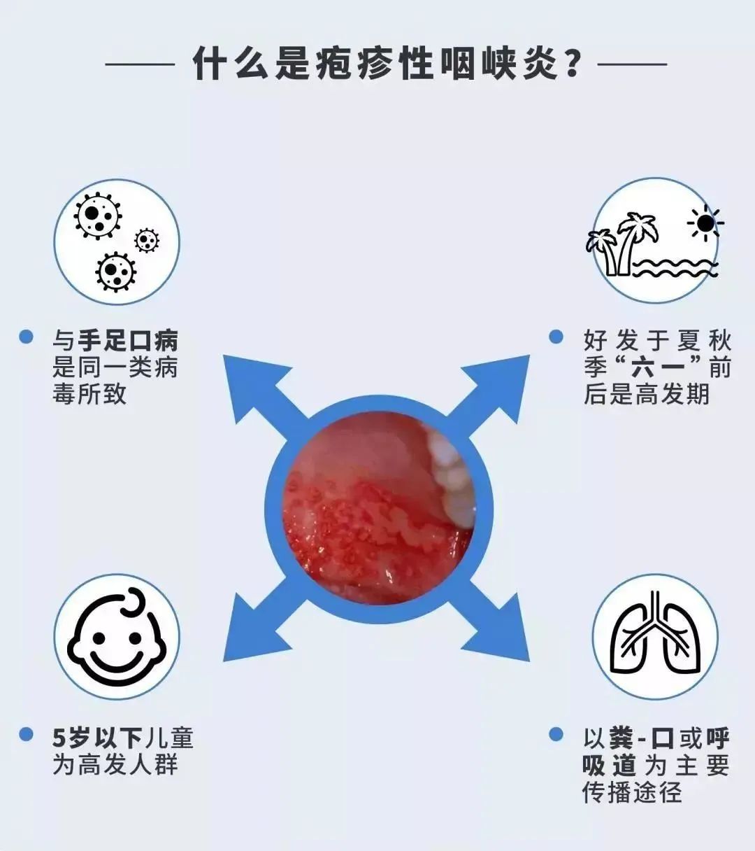 喉炎的症状图片