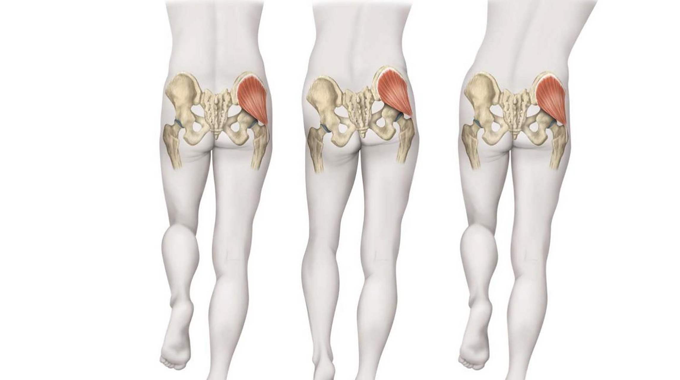 臀中肌是髋关节的重要稳定肌,其失能会减弱髋关节的稳定性,容易导致