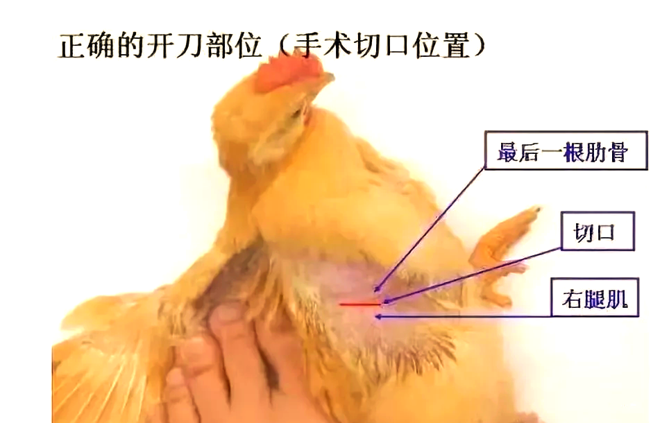 接下来,我们将深入探讨与手术部位相关的解剖构造