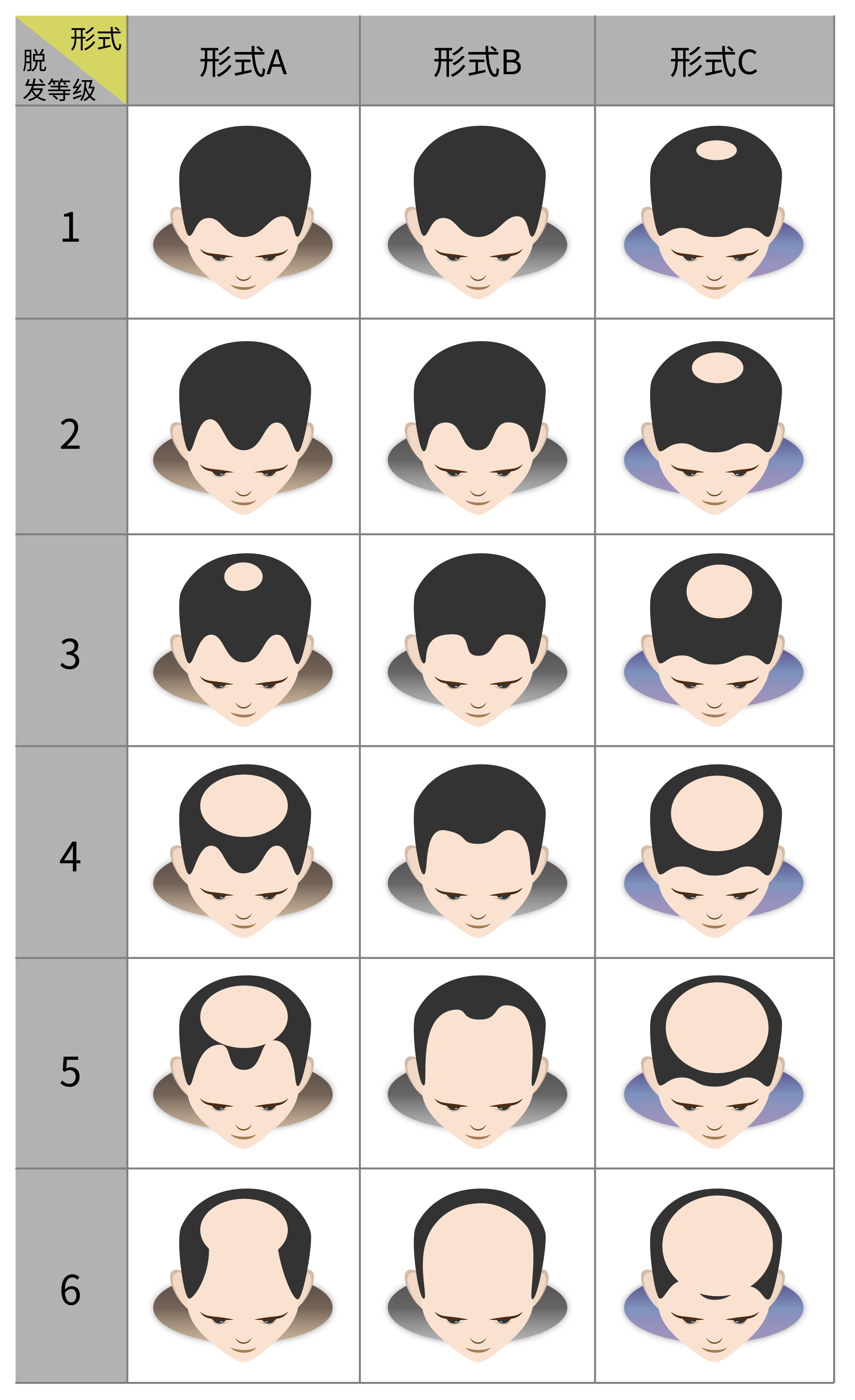 脱发1-7级程度图片图片