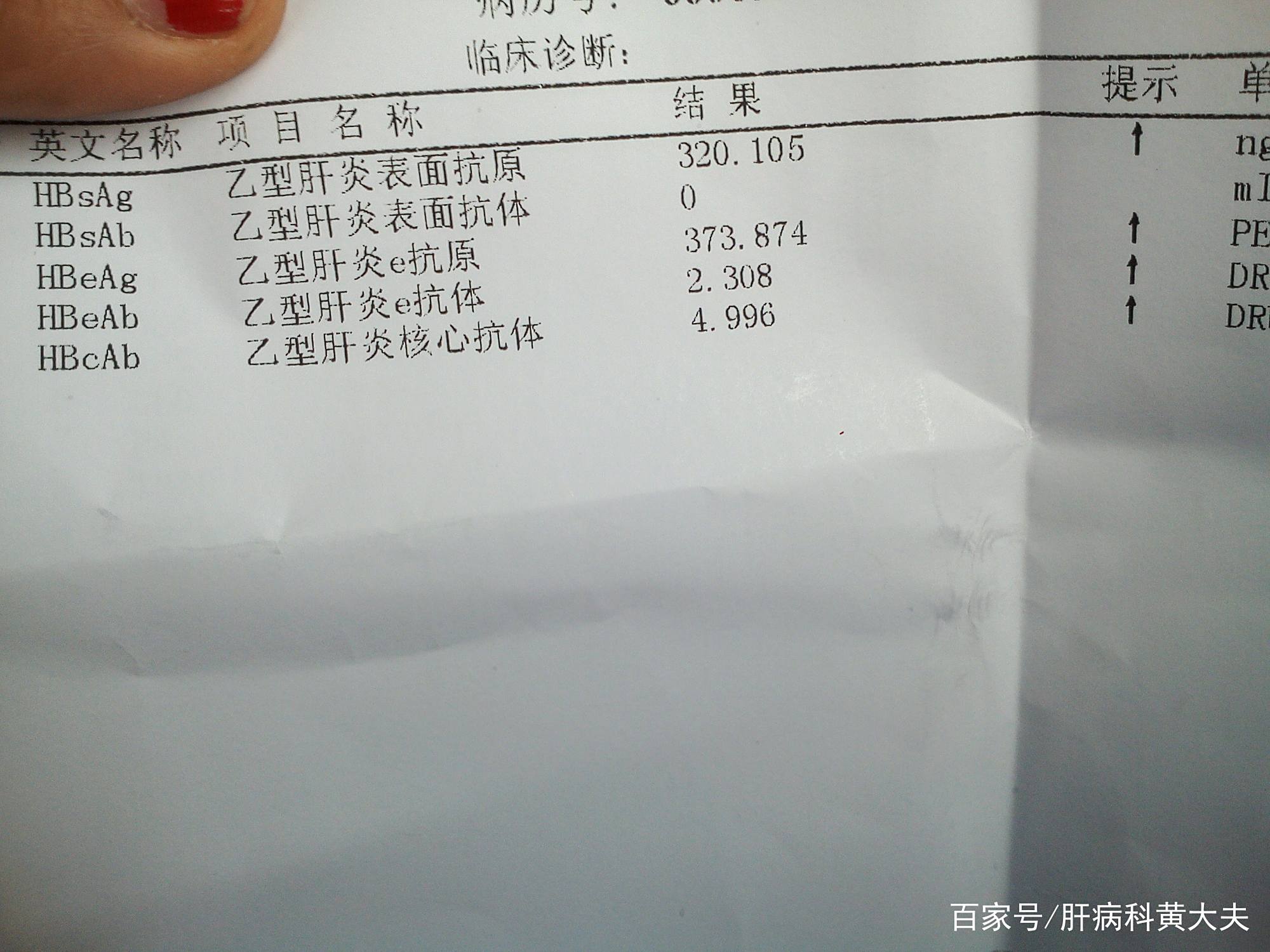 大三阳会不会传染 baijiahao.baidu.com